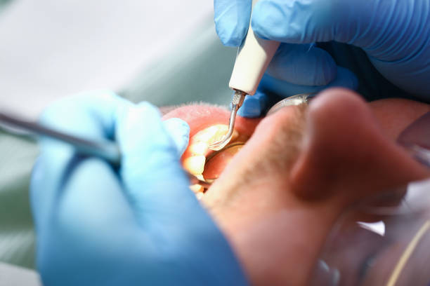 Best Emergency Treatment for Toothache in Gate City, VA
