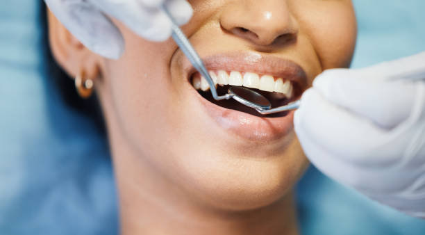 Best Emergency Root Canal Treatment in Gate City, VA